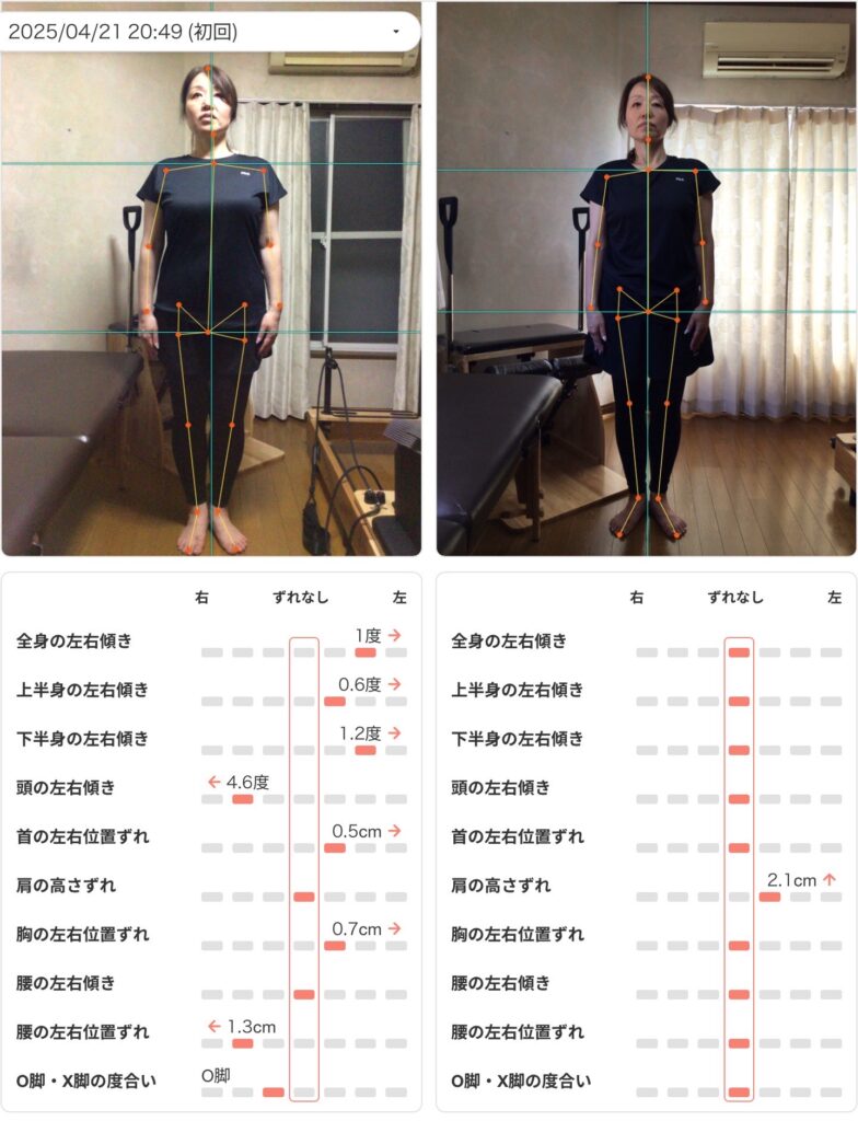 骨格・姿勢AI診断のカルテ画面