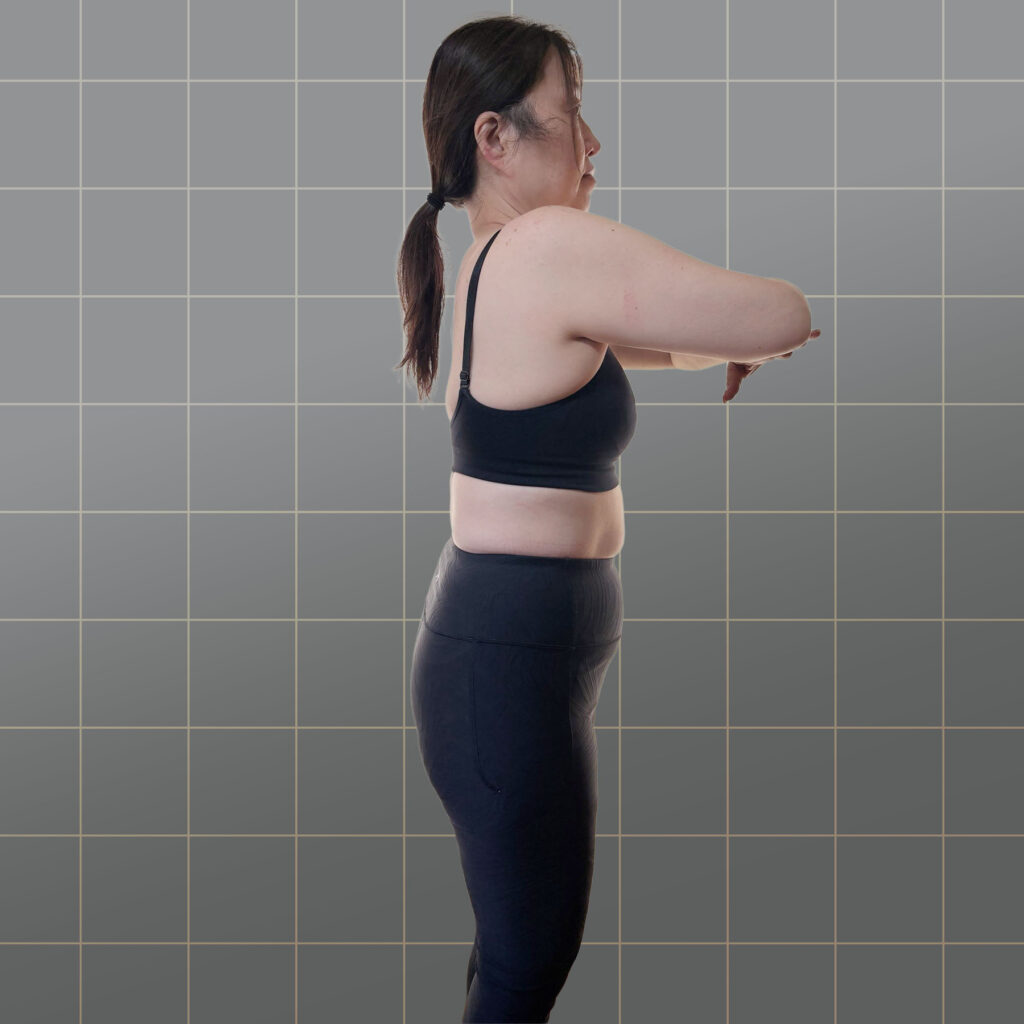 50代・女性／O脚・骨盤横張り改善のビフォー。