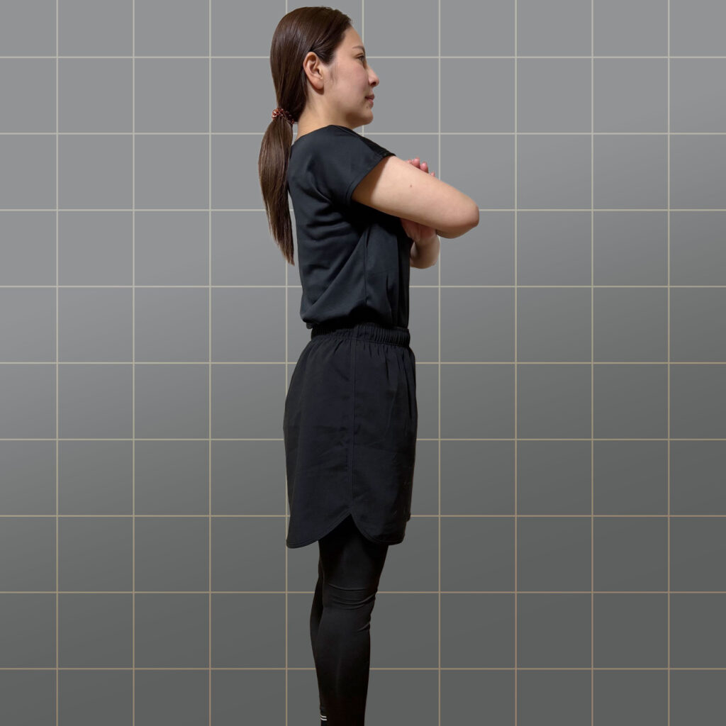 30代・女性／巻き肩・反り腰改善のビフォー。